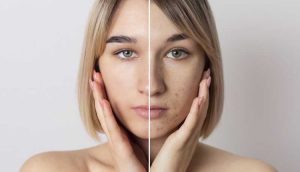 راهنمای آرایش پوست خشک و حساس 
